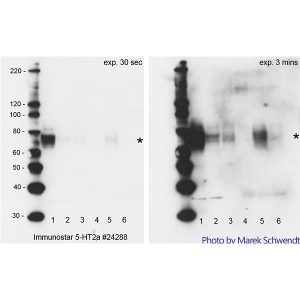 5-HT (Serotonin) 2A Receptor Antibody