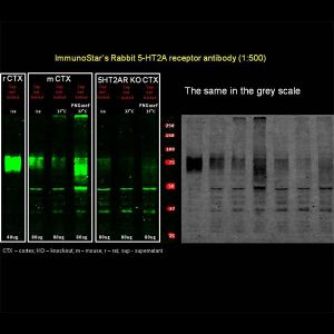 5-HT (Serotonin) 2A Receptor Antibody