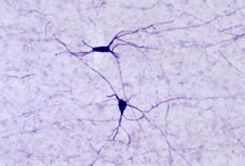 nNOS:N-Terminal (Neuronal Nitric Oxide Synthase) Antibody