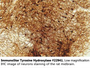 Tyrosine Hydroxylase Antibody