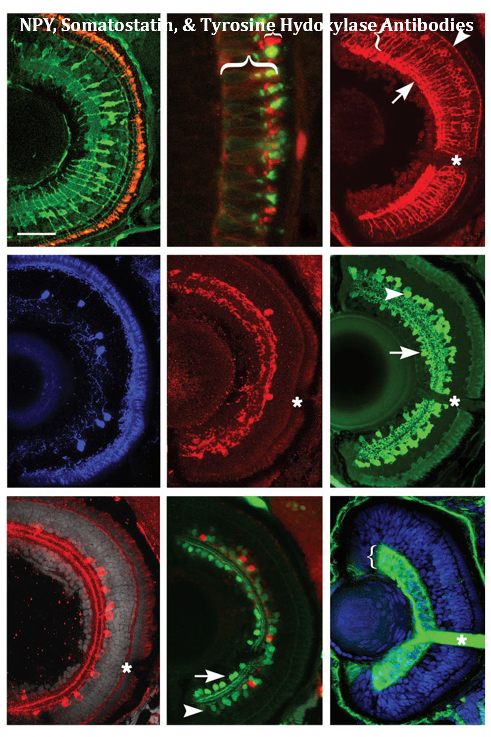 Analysis of the Retina in the Zebrafish Model Andrei Avanesov and Jarema Malicki, Tufts Univ.